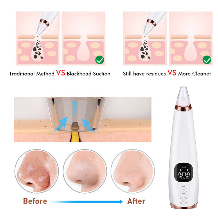 Electric Microcrystalline Blackhead Remover