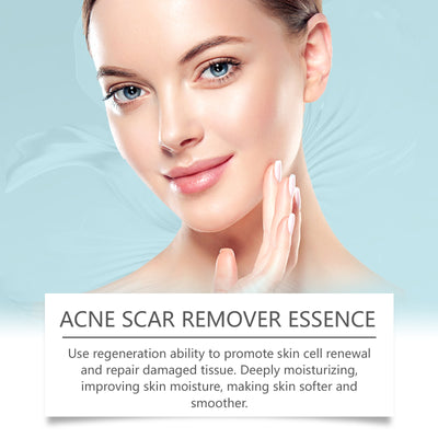 Acne Scar Remover